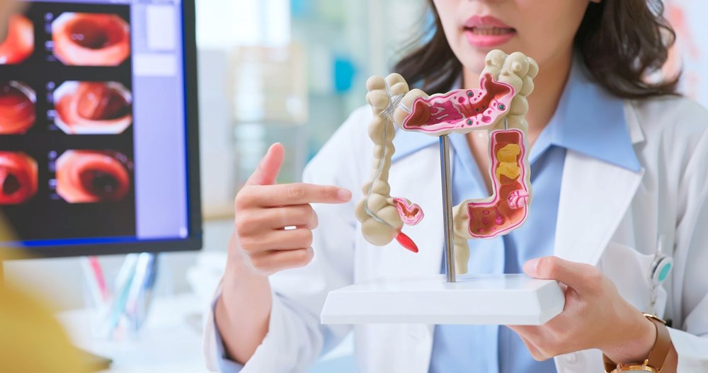 Bağırsak kanseri neden arttı?