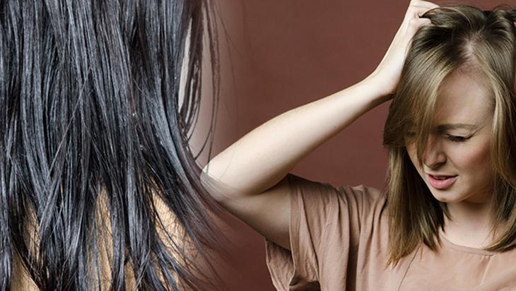 Kafanız hatır çok kaşınıyorsa çaresi var!