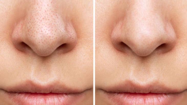 Korelilerin güzellik sırrı buymuş! Kozmetiği rafa kaldırıyor, sıfır iz sıfır gözenek